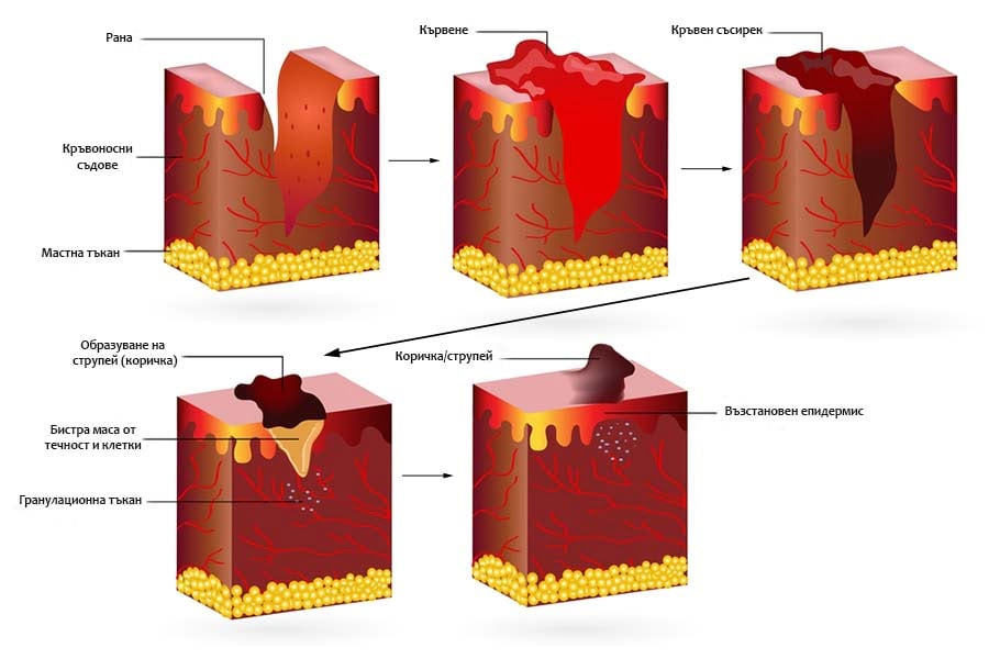 Зарастване на рани, съвети за бързо зарастване.