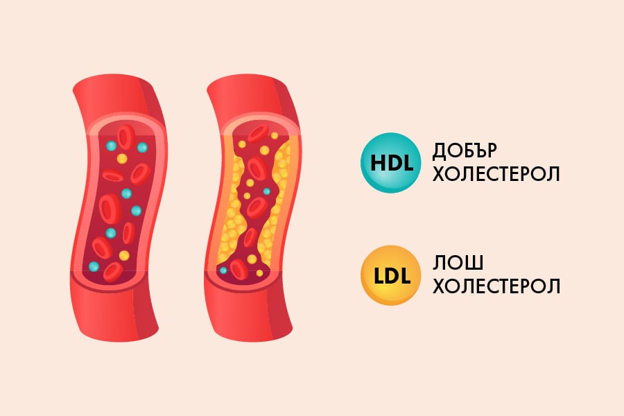 dobar-i-losh-holesterol dobar i losh holesterol