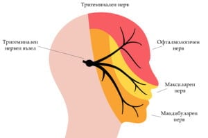 6 средства за облекчаване на невралгия 5 Средства за облекчаване на невралгия.