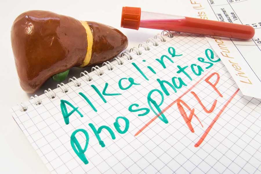 Алкална фосфатаза-черен дроб