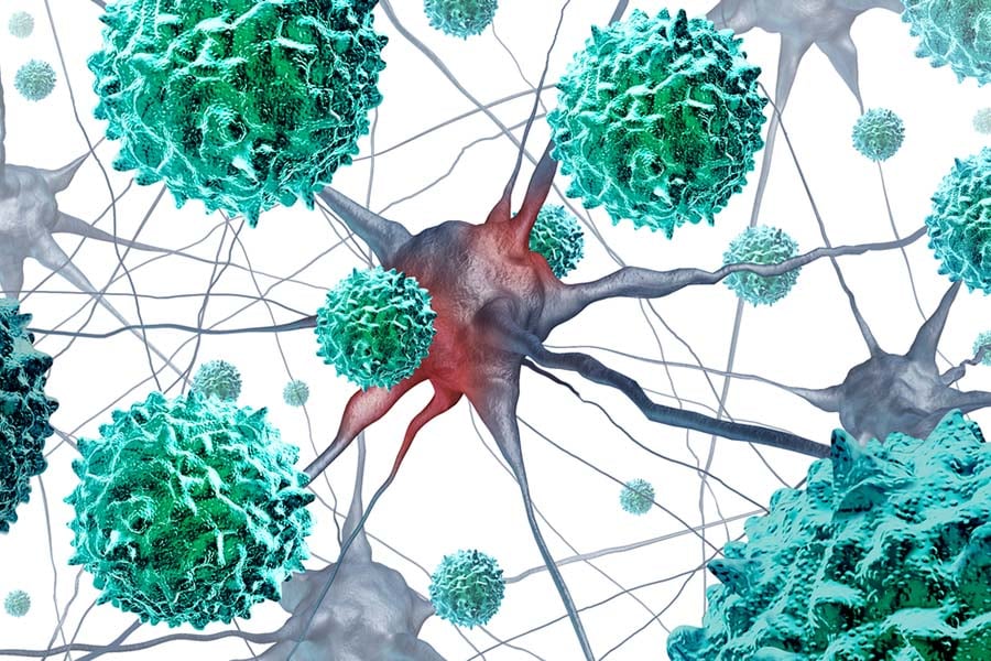 Полиомиелит.