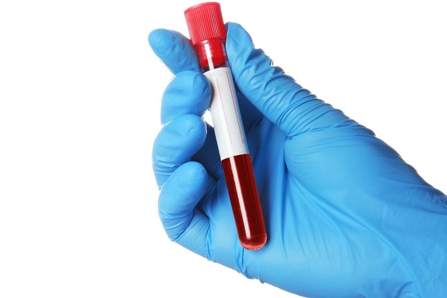 следродилна анемия и кърмене