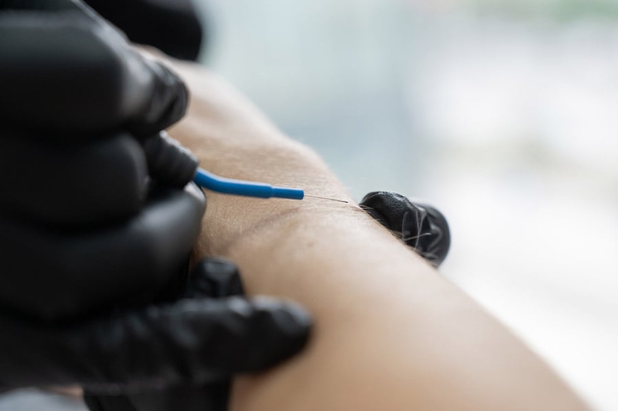 Съдови звезди.