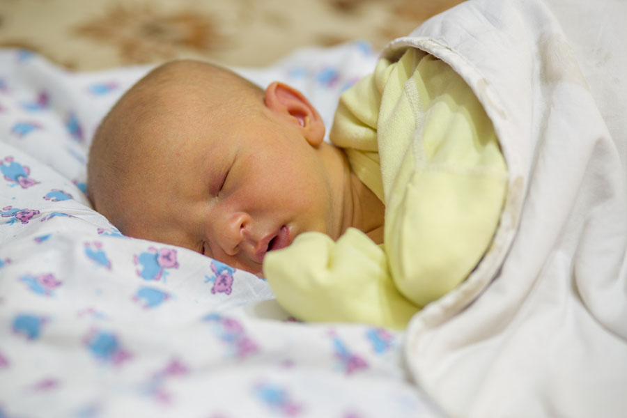 Физиологична жълтеница при доносено новородено.