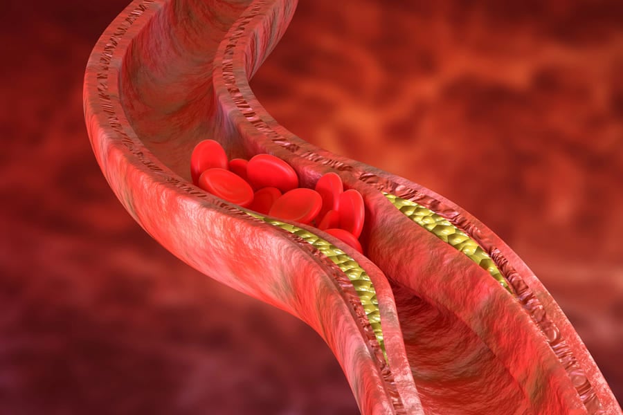 Какво е берберин?