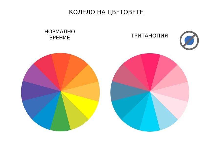 Далтонизъм – цветна слепота 6 Тританопия - вид далтонизъм.