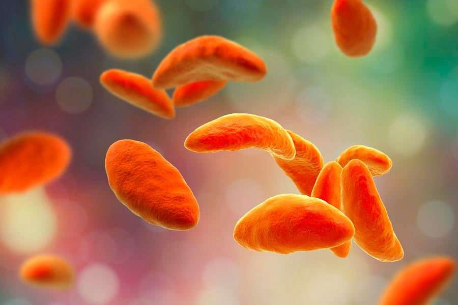 токсоплазмоза