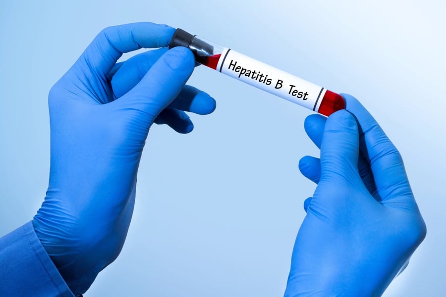 Хепатит Б – какво трябва да знаем? 6 Хепатит Б – кръвен тест.