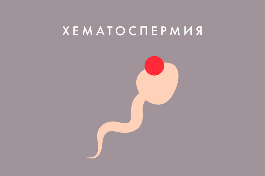 хематоспермия