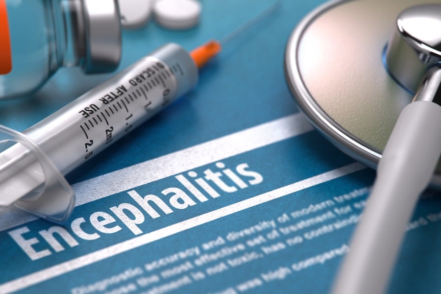 Енцефалит – причини и признаци на болестта 7 Инжекция и енцефалит