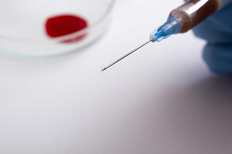 токсичен хепатит