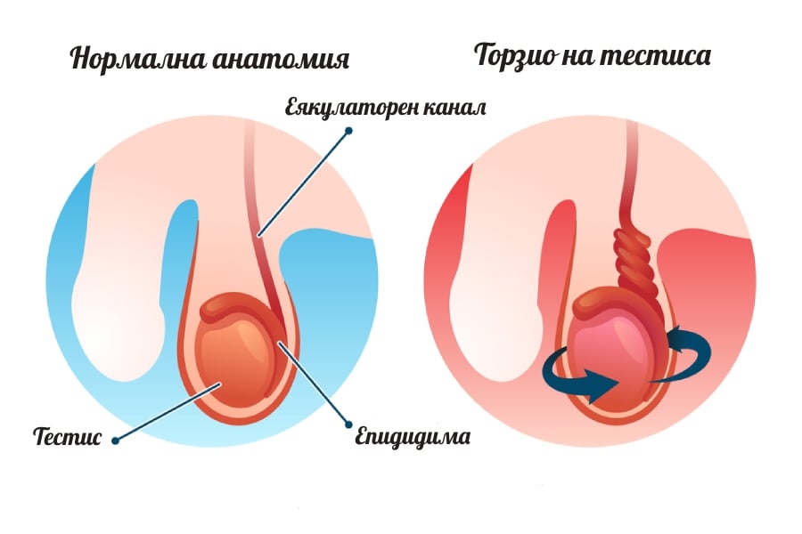 Торзио на тестиса – анатомия.