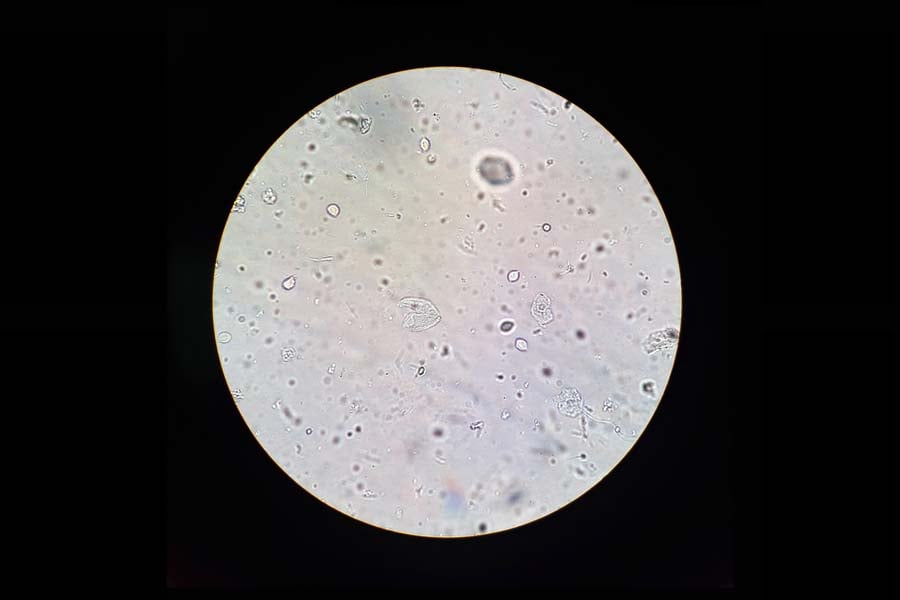 trihomoniaza 1 redact
