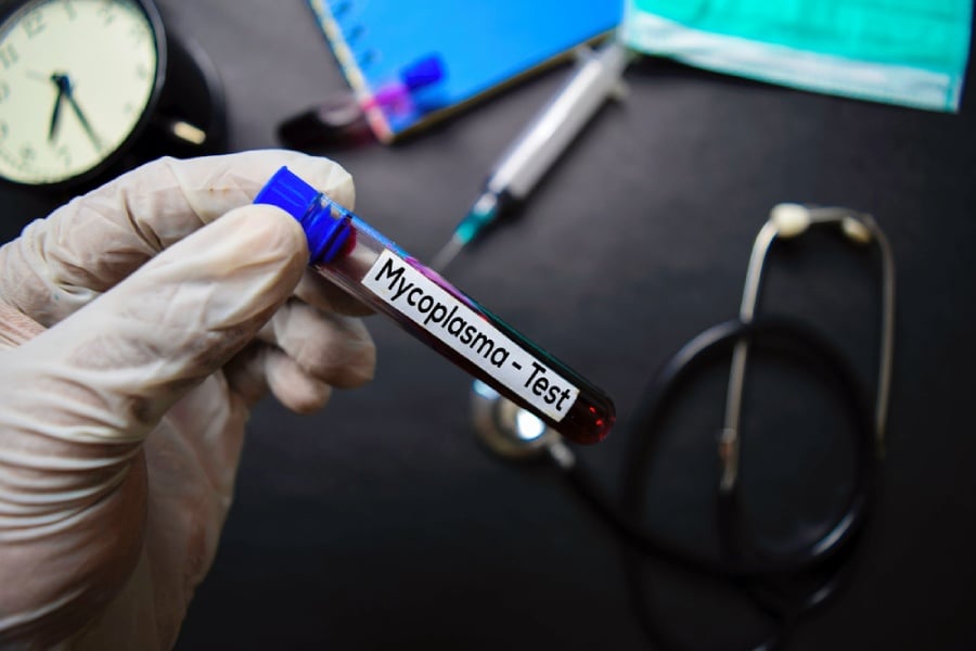 Микоплазма тест