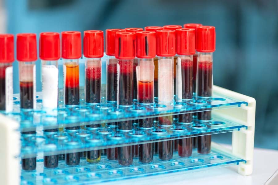 тест за моноцити