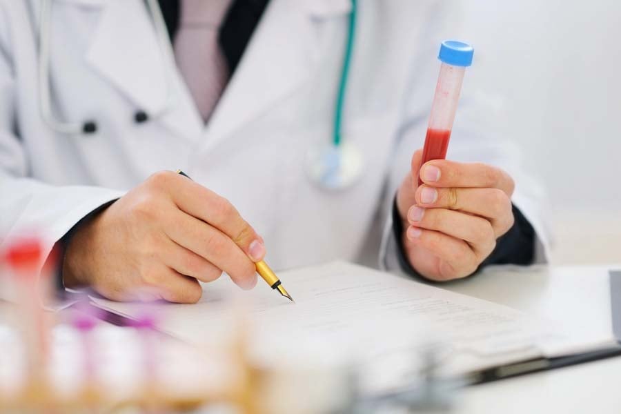 тест за моноцити