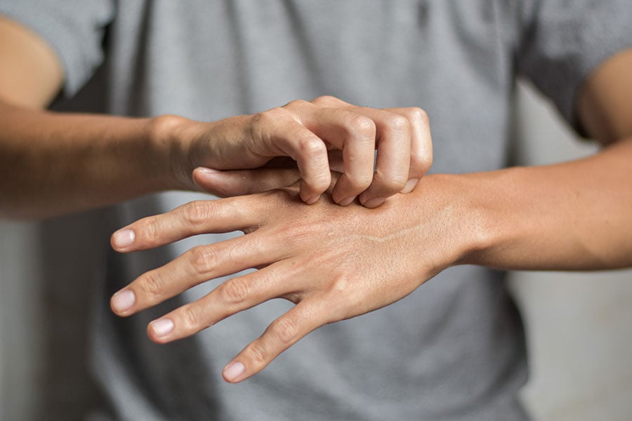 krasta-skabei Краста, скабей.