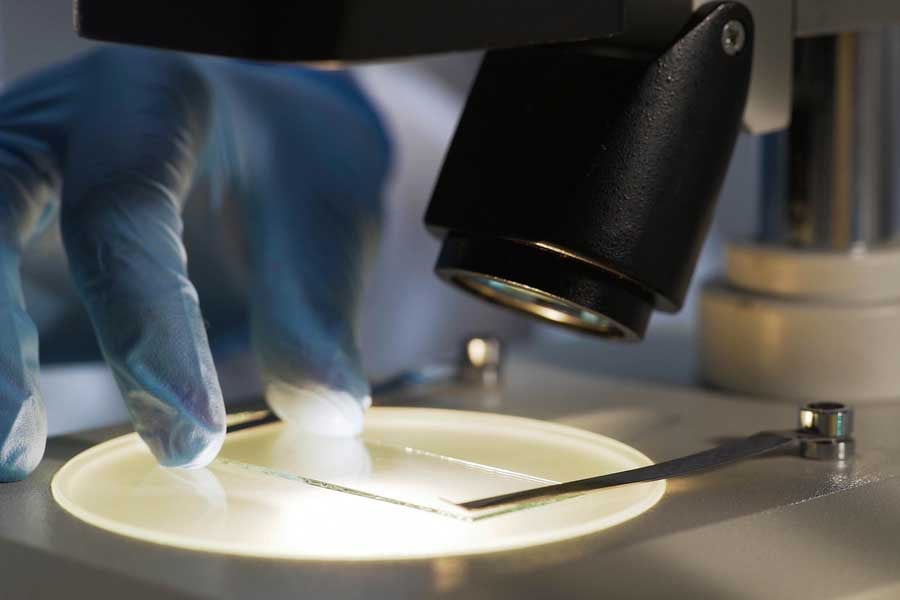 уреаплазма