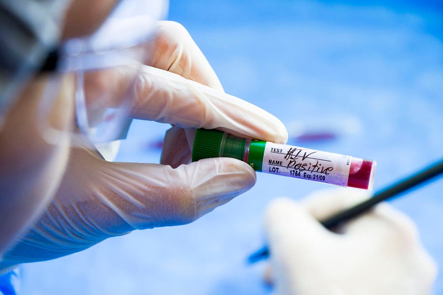 Професор Златко Кълвачев, асистирана репродукция на хора с ХИВ.