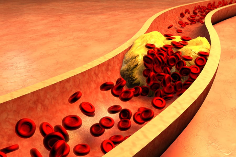 Сапонини: значение, видове и съдържание в храните 5 сапонини