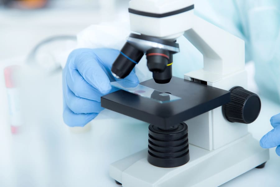 biopsiya биопсия