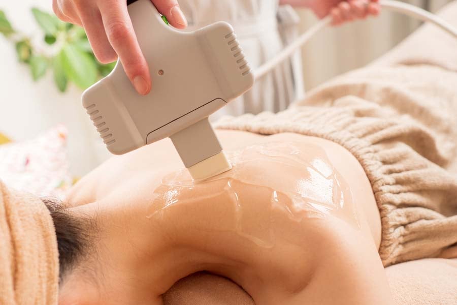 фотоепилация