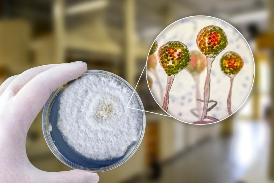 Тест за мукормикоза.