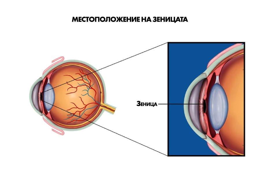 Анизокория, зеница