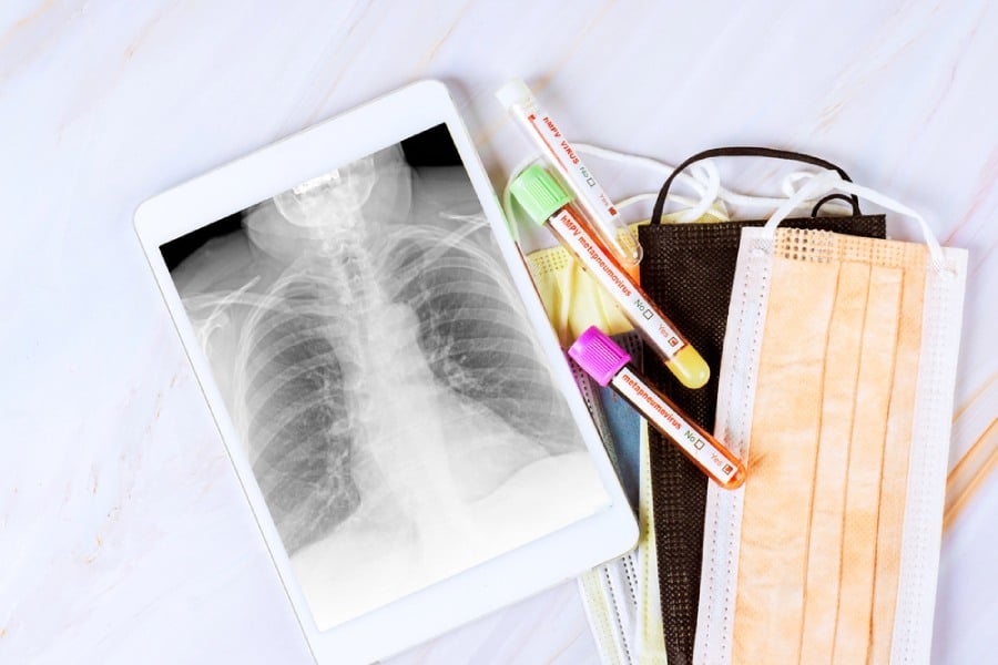 Метапневмовирус, диагностика