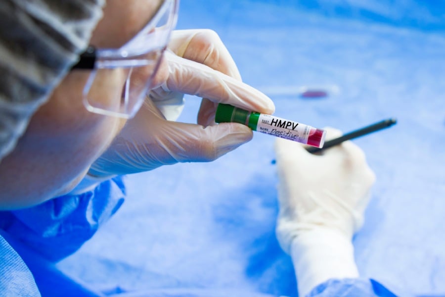 Метапневмовирус в лаборатория