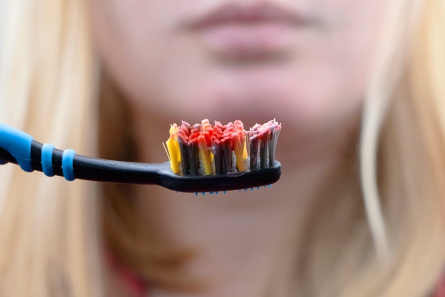 отдръпване на венците, кръв по четката