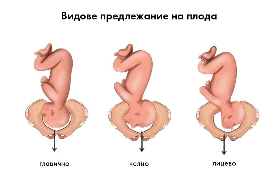 Позиция на главата, предлежание на плода
