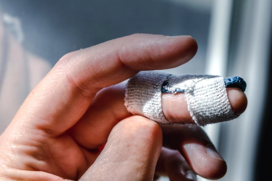 Пръст чукче, лечение