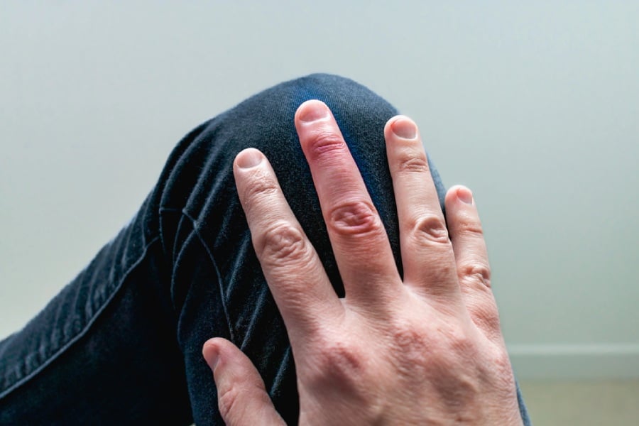 Пръст чукче, заздравяване