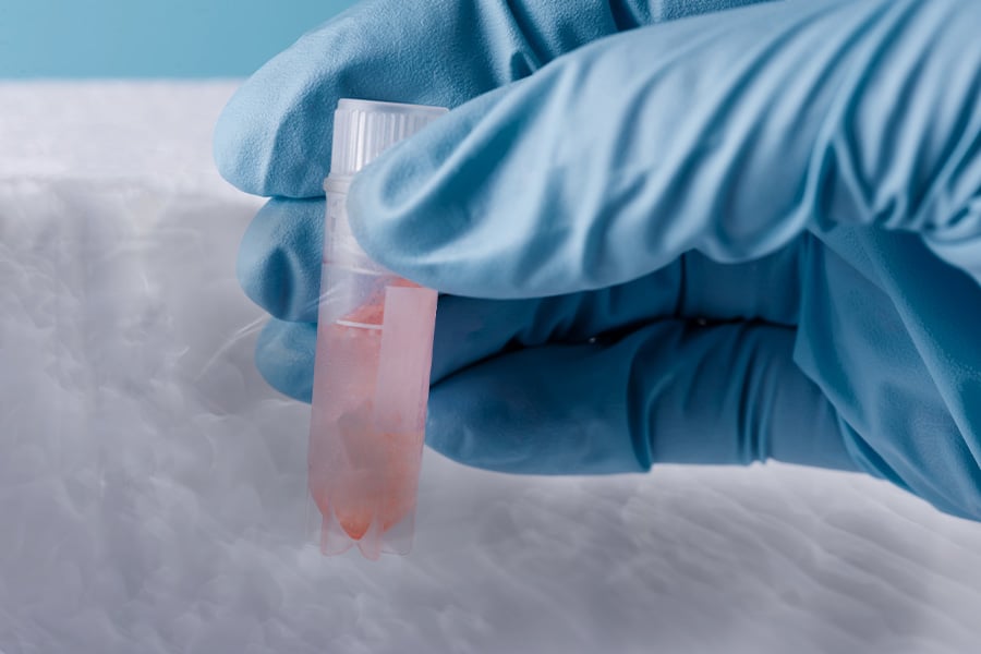 стволови клетки