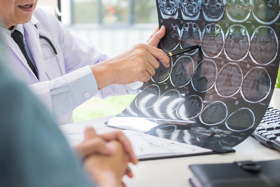 nevrofibromatoza неврофиброматоза