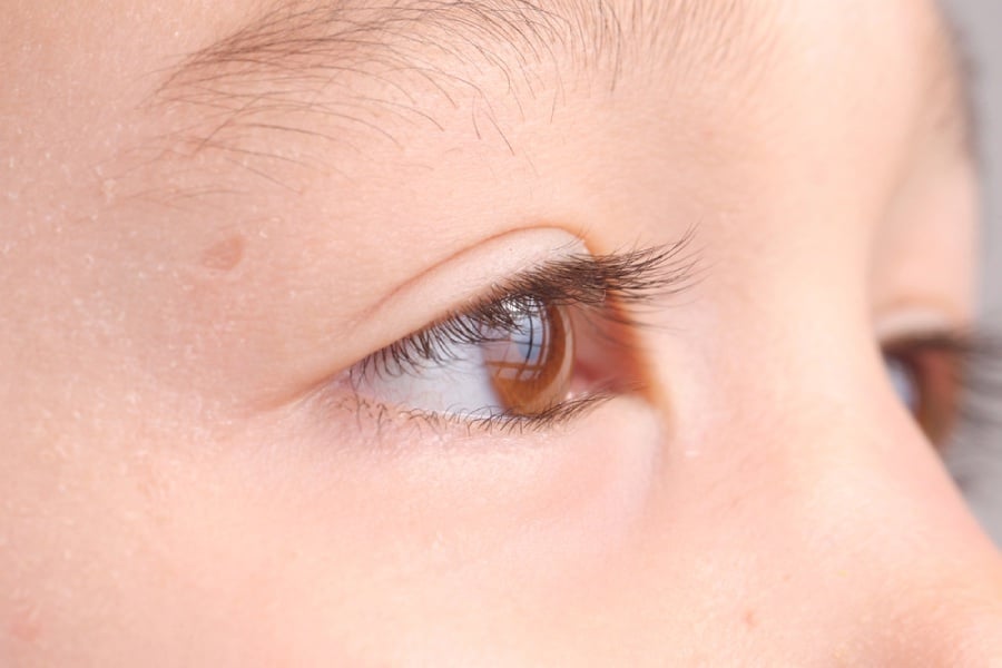 Болест на Коутс