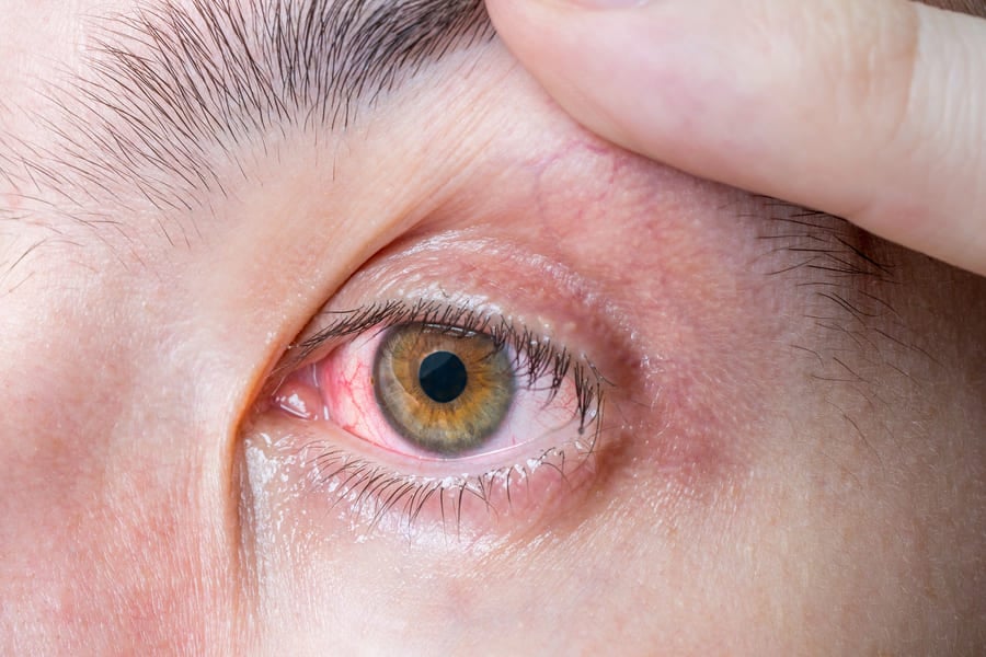 как влияе мръсният въздух на очите