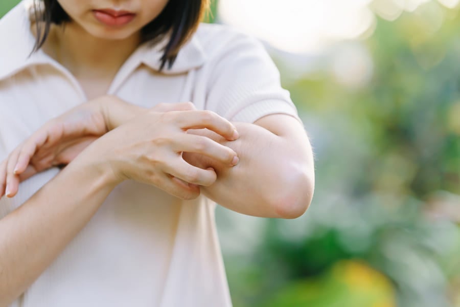 херпетиформен дерматит