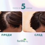 Фоликсил спрей против косопад.