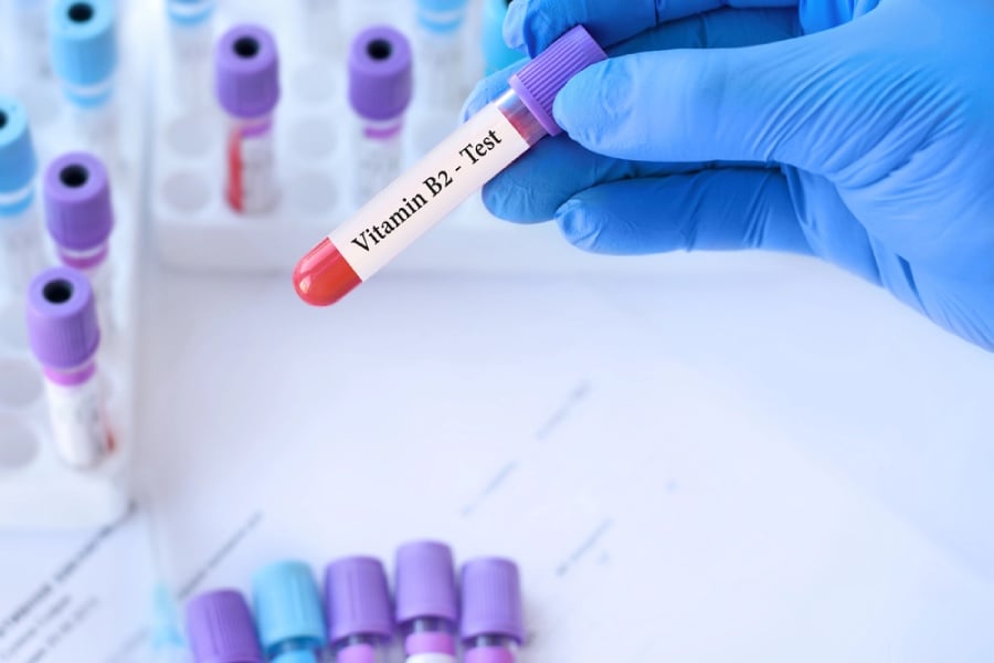 рибофлавин, тест