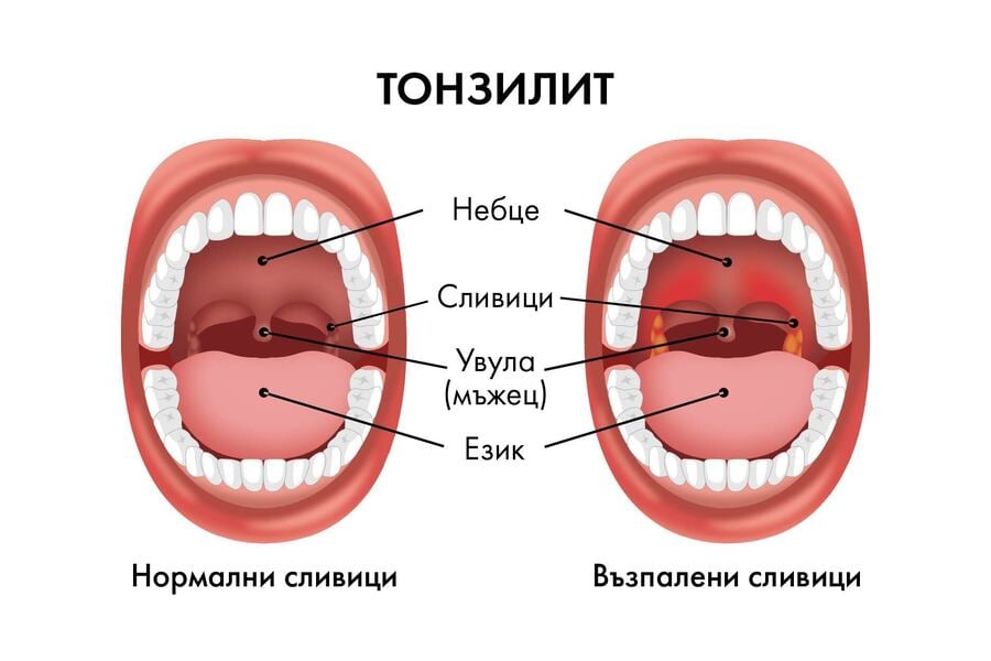 сливици