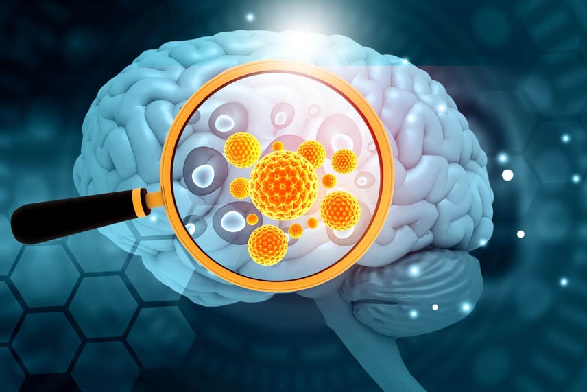 Менингит, вследствие на Haemophilus influenzae