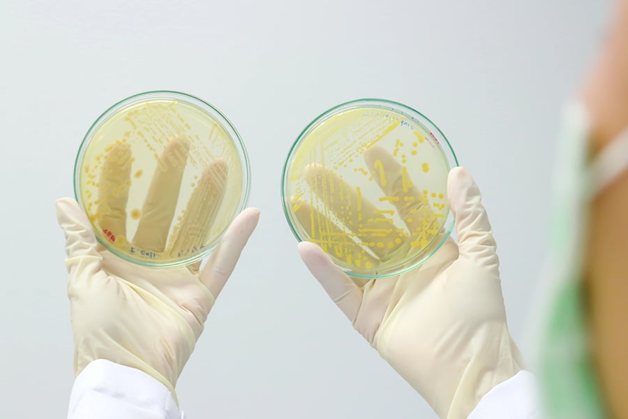 Haemophilus influenzae бактерия.