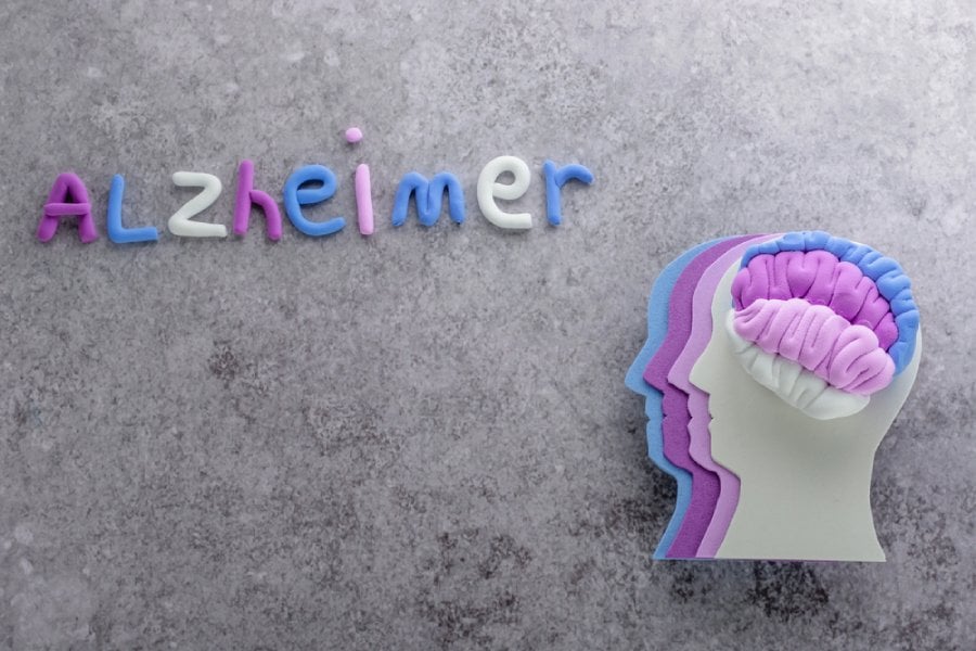 Alzheimer , болестта на Алцхаймер