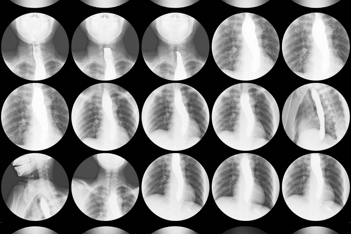 Бариева каша.