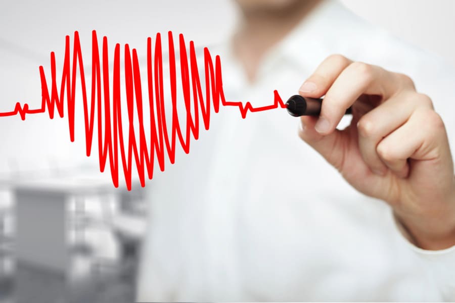 Ангиография.