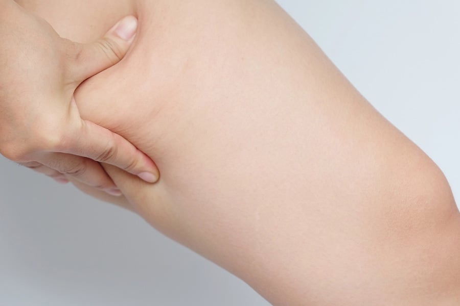 без целулит за 10 дни