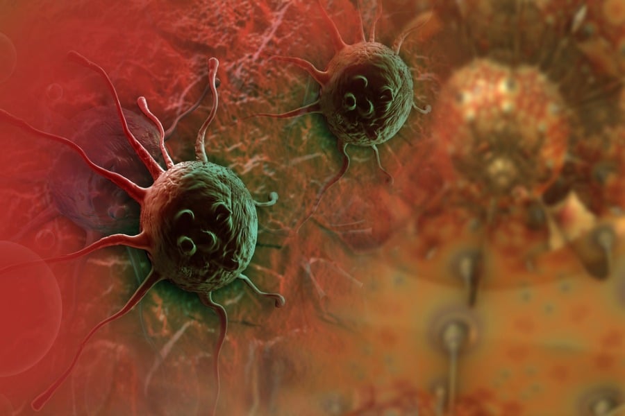 Зеленчуците, които намаляват риска от рак на дебелото черво 8 риска от рак на дебелото черво