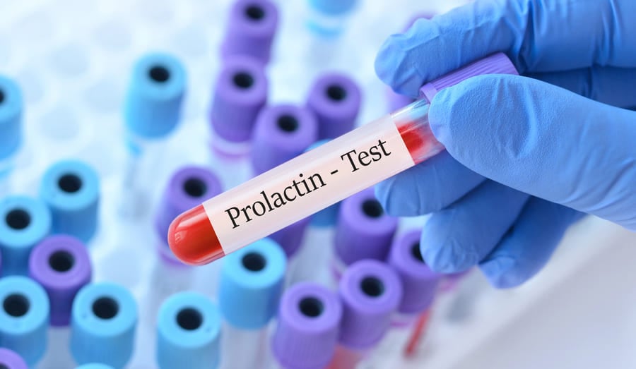 Храни за понижаване на пролактин + други полезни съвети 18 Храни за понижаване на пролактин